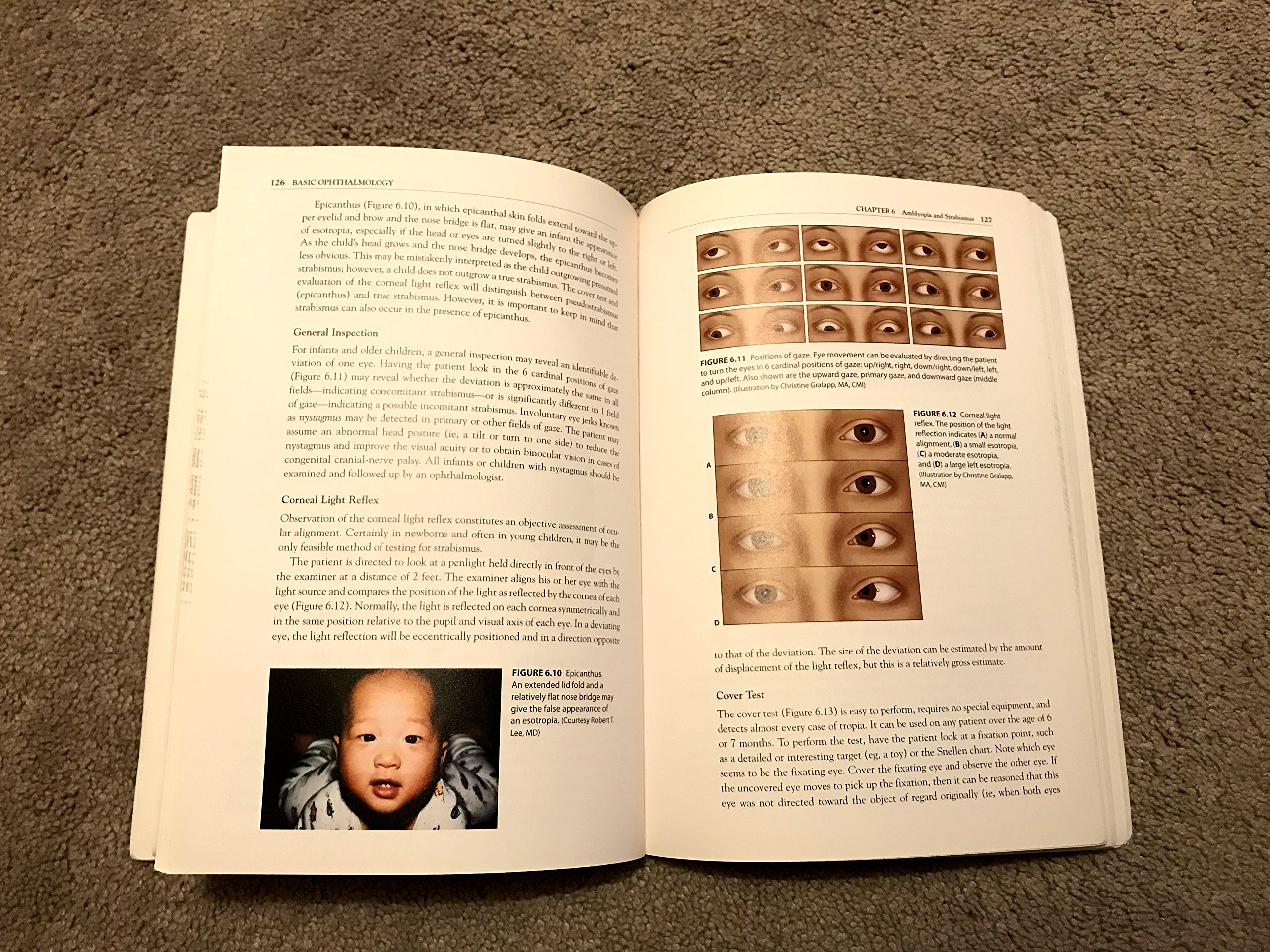 Basic Ophthalmology 2