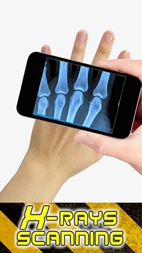 Prank - X Rays Scanning