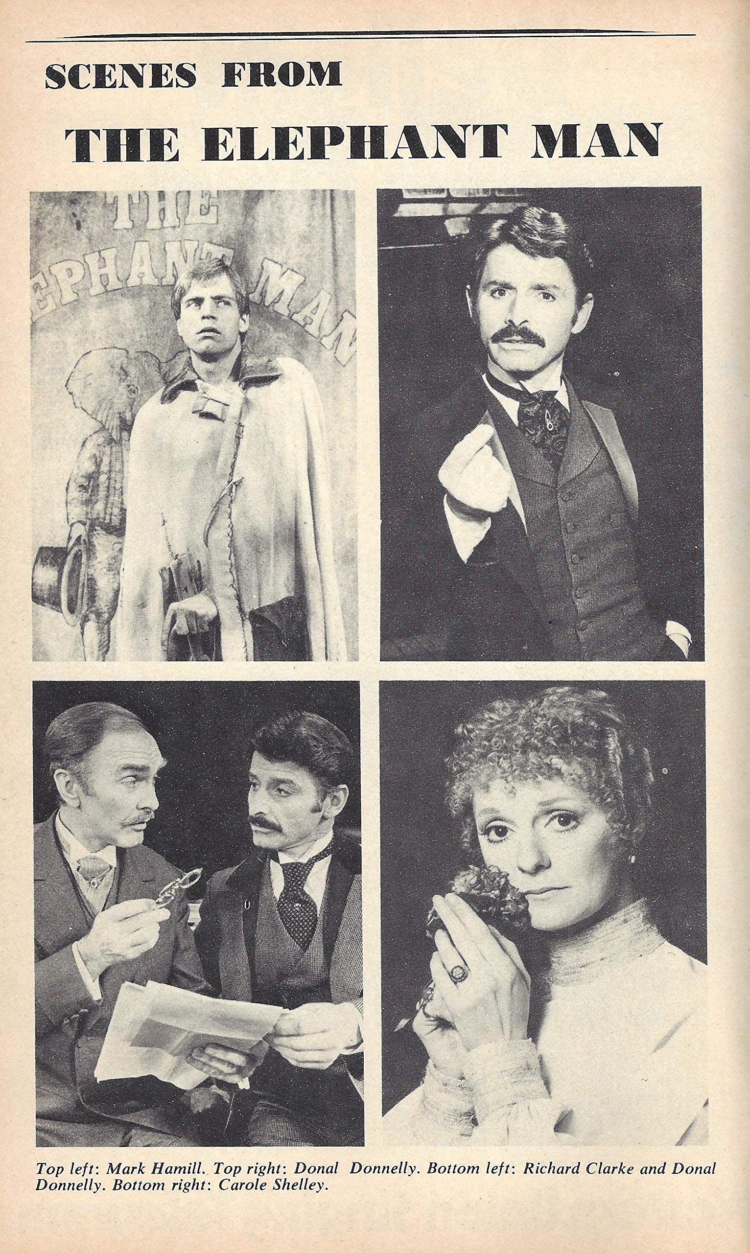 The Elephant Man Broadway Cast