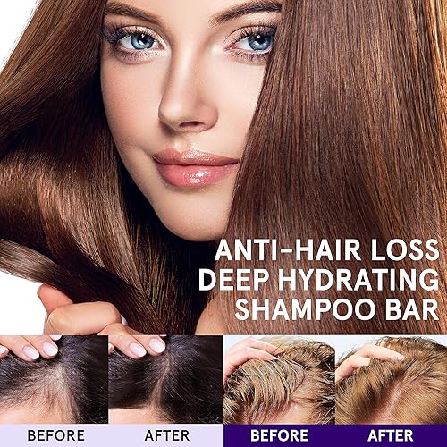 Miniatura 2 de Barras de champú para el crecimiento del cabello, barra de champú sólida para cabello seco y dañado, barra de champú con soporte, hidratación