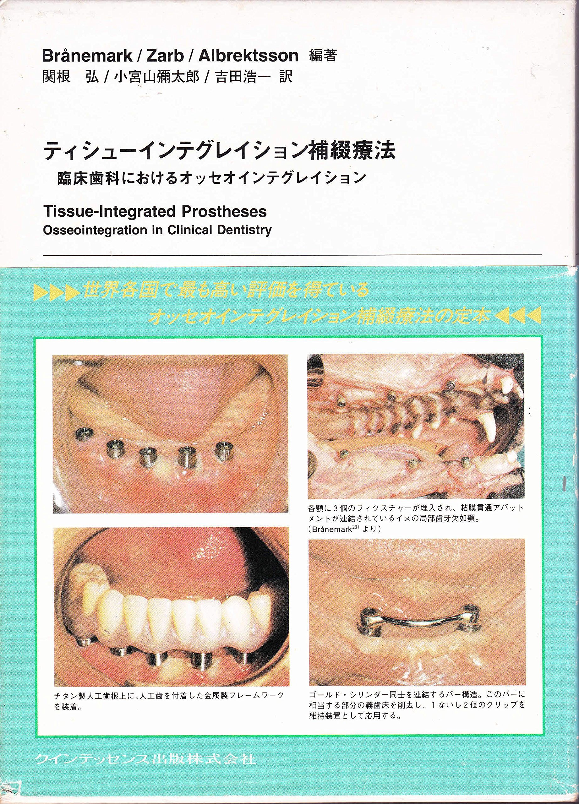 ティシュインテグレイション補綴療法 ティシュ-インテグレイション補綴療法: 臨床歯科におけるオッセオ