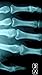 Xray Scanner
