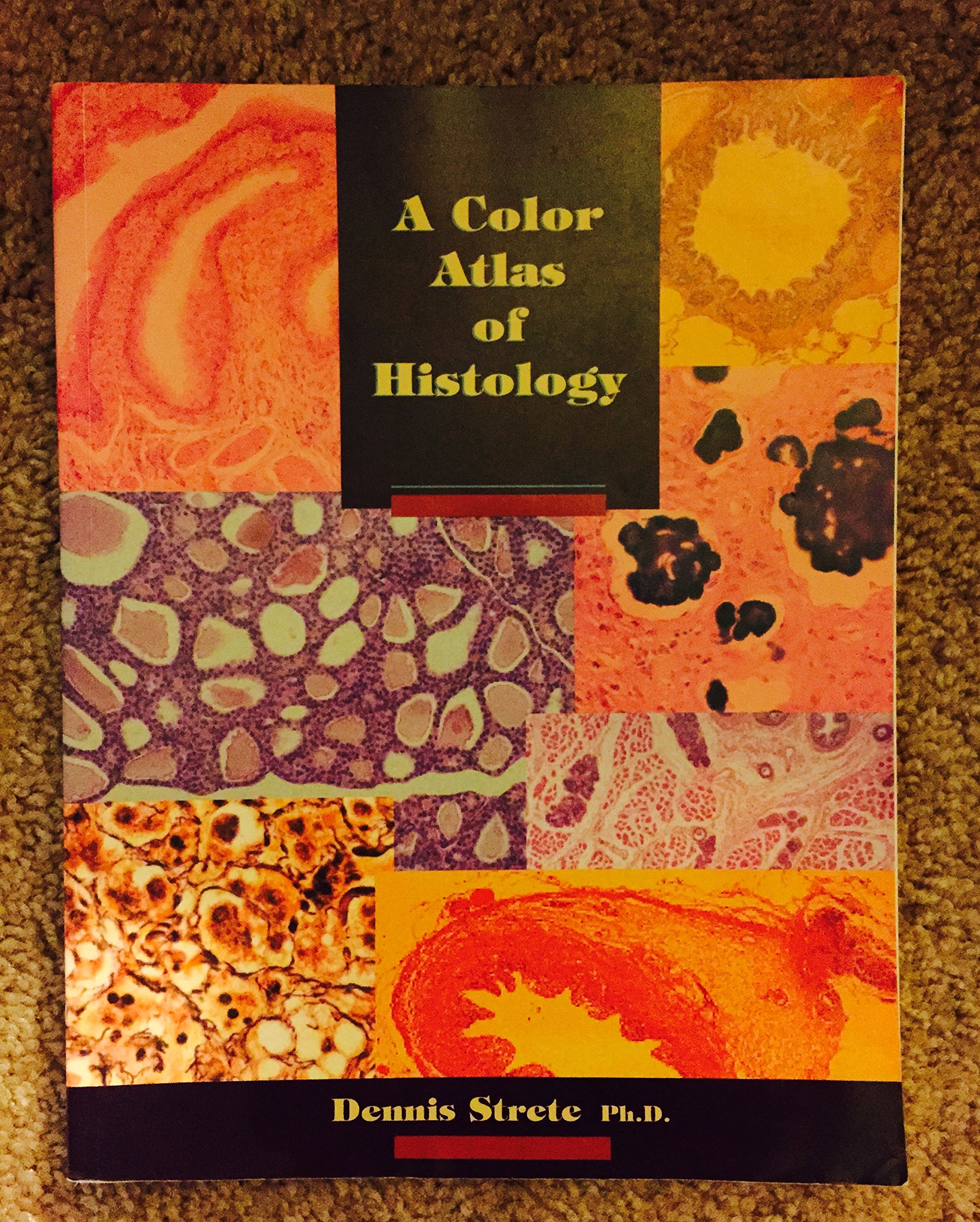 Ｓｔｒｅｓｓ　ｔｈｅｏｒｙ　ａｎｄ　ｐｈｏｎｏｌｏｇｙ　ｉｎ　ｏｌｄ　ａｎｄ　ｍ/リ-ベル出版/上梨恵子（単行本） Amazon.com: Case Studies in Abnormal Psychology
