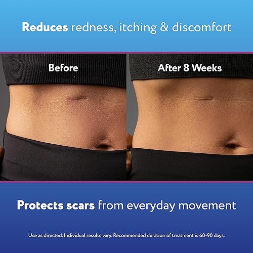 Miniatura 6 de ScarAway Gel de disminución de cicatrices 035oz