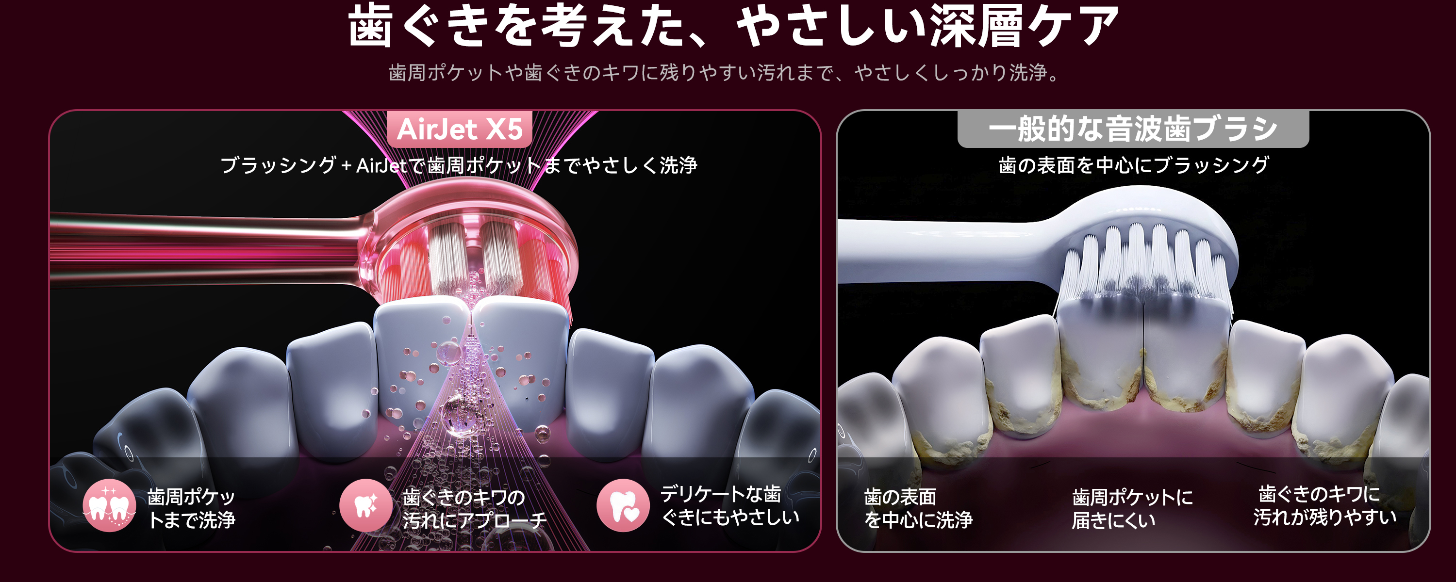 Amazon.co.jp: 【歯周ケア特化 次世代バブルジェット洗浄】RANVOO