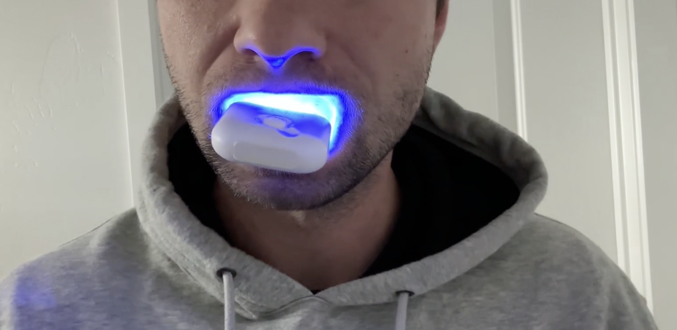 Watch What You Need To Know Before You Buy PDOO Teeth Whitening on Amazon Live