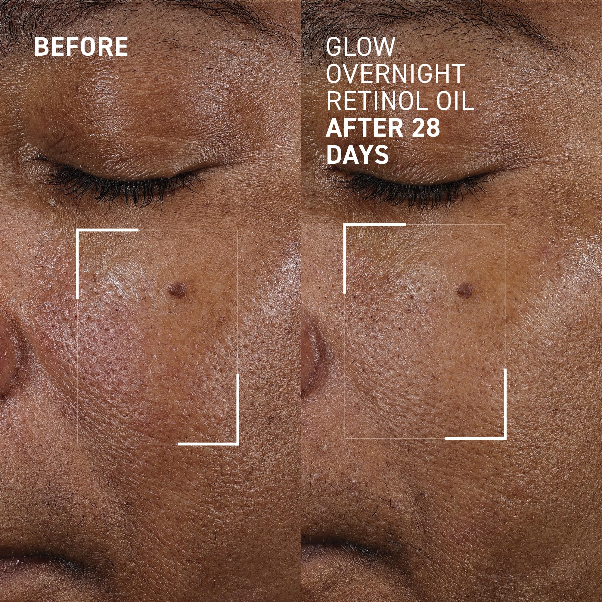 Dr. Brandt Bright This Way Glow Overnight Retinol Oil - Pure 2% Retinol Improves Wrinkles, Lines & Skin Texture - 30 mL - Image 3