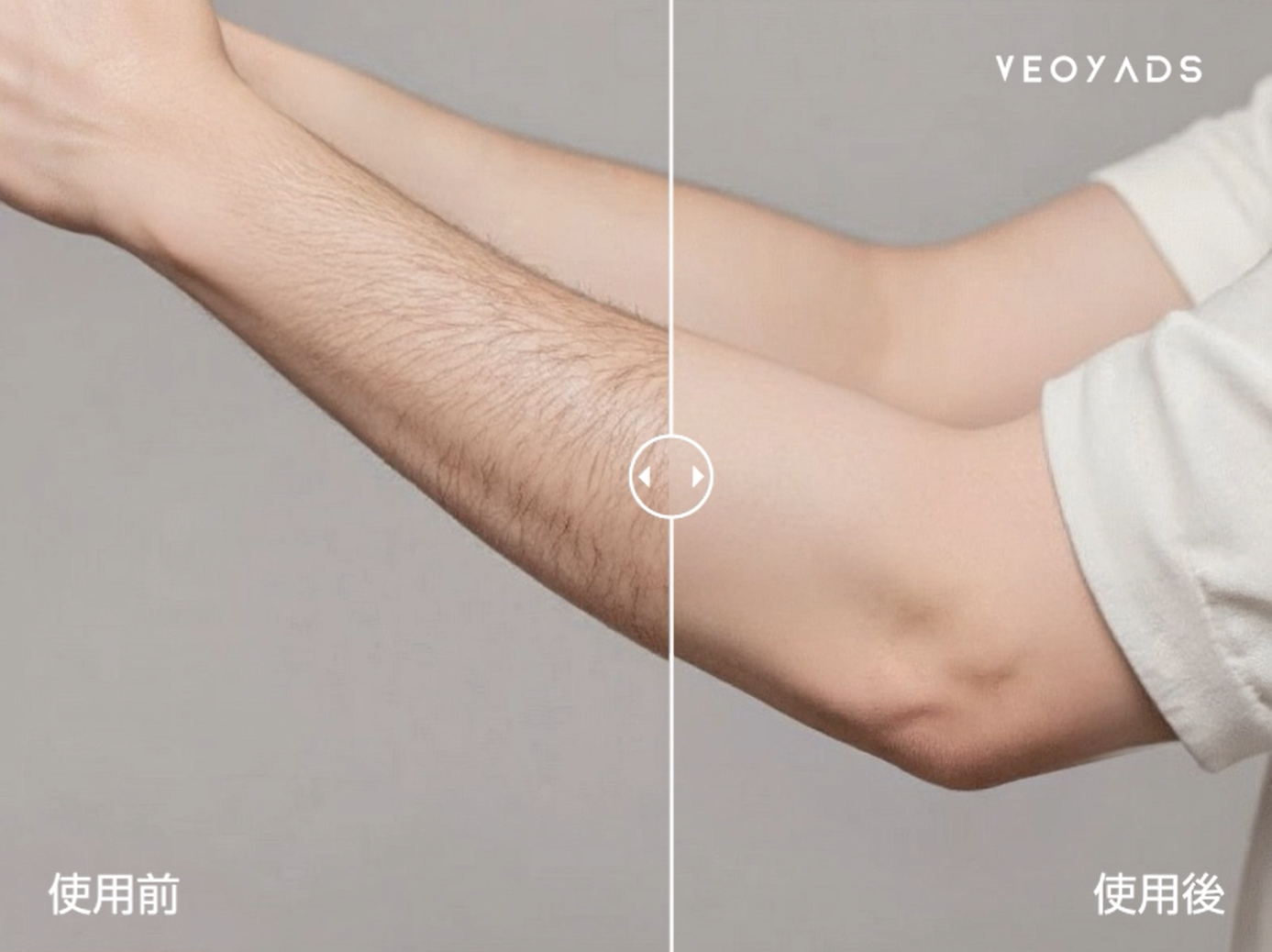 Amazon | VEOYADS HIPL 脱毛器【ドイツのiFデザイン賞受賞 サファイア