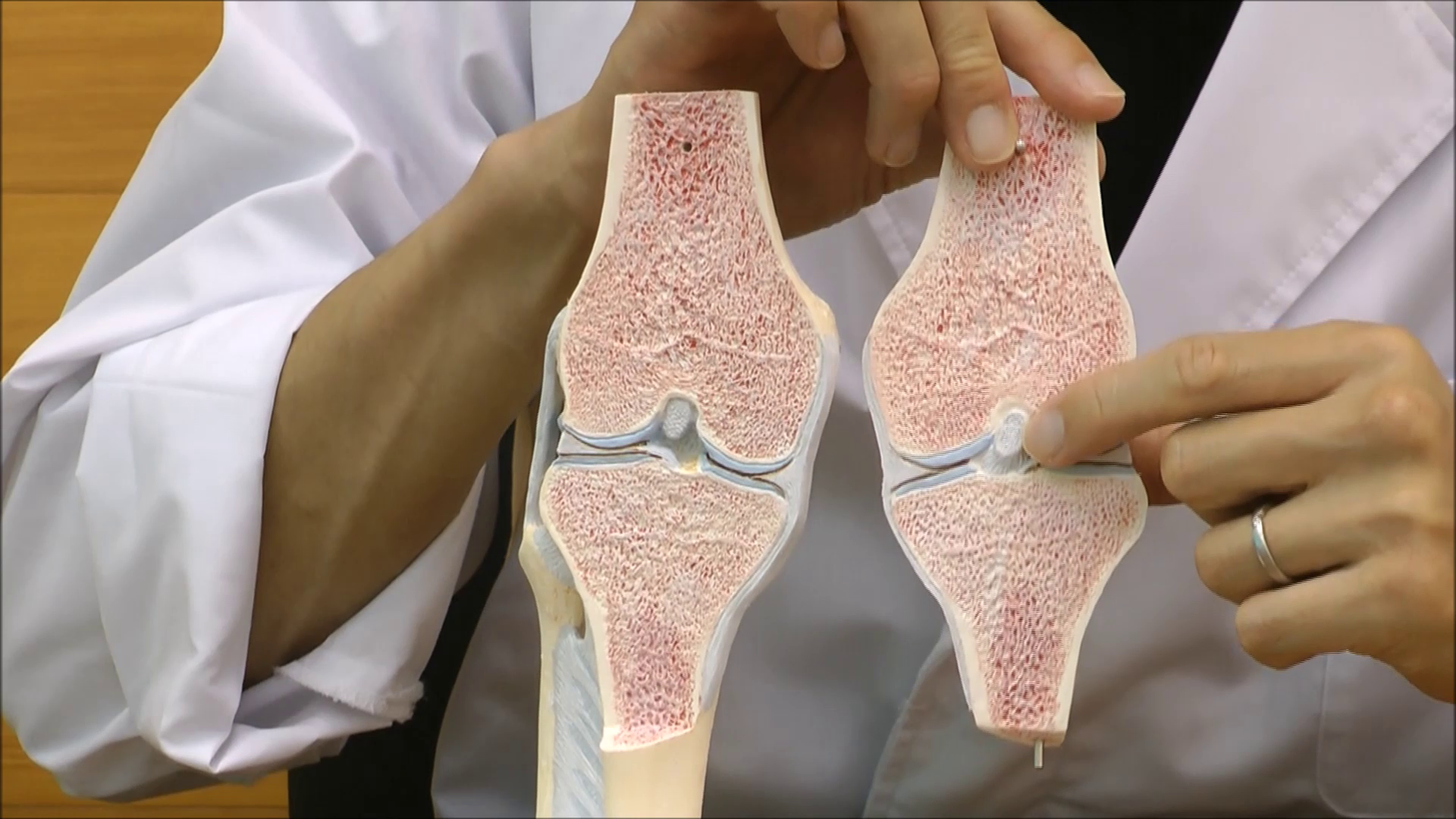 Amazon.co.jp: 膝関節の内部構造を観察できる模型です - 膝の