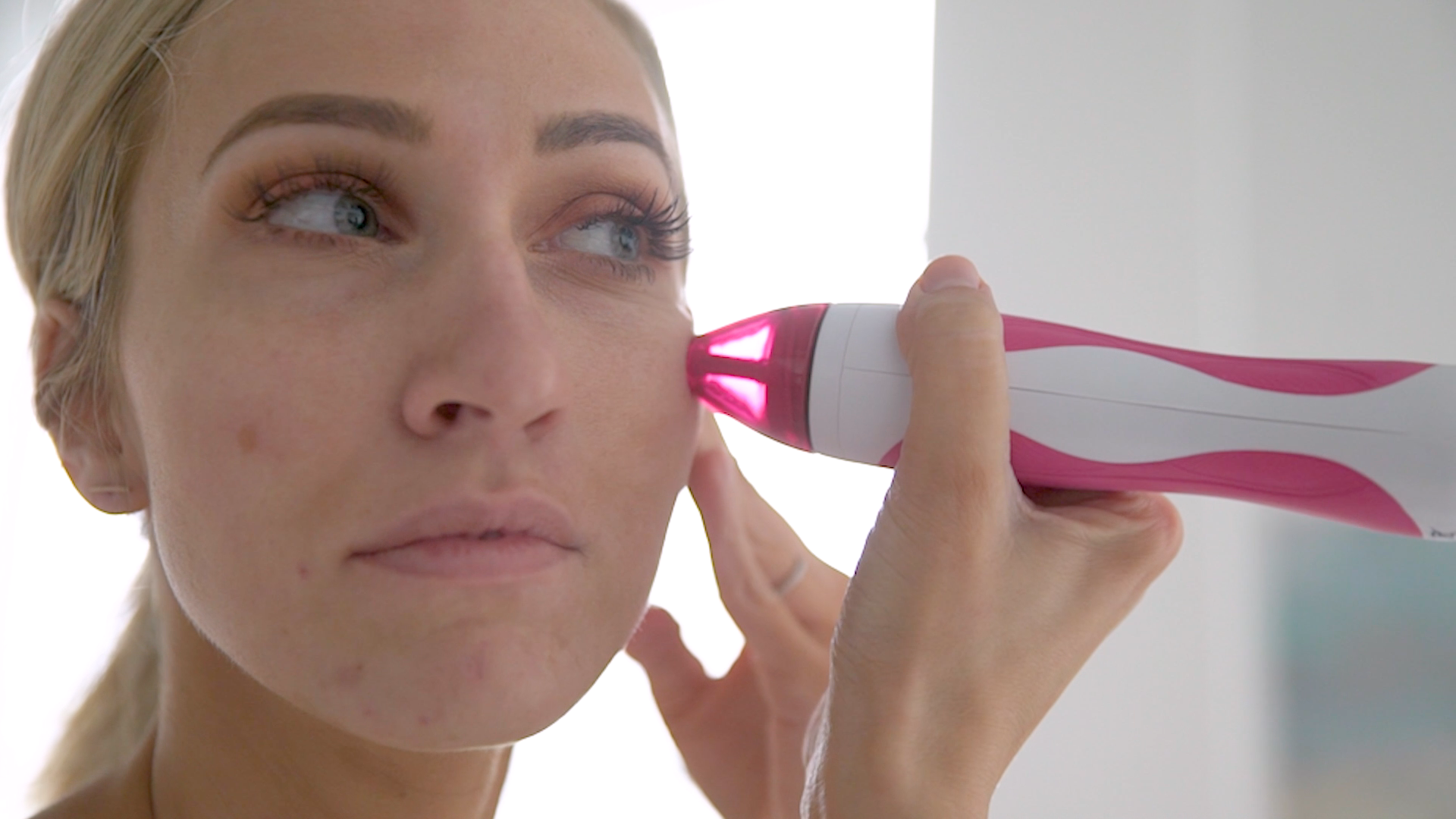 PMD Beauty Personal Microderm Man - At-Home Microdermabrasion Machine with Kit for Face & Body - Exfoliating Crystals and Vacuum Suction for Bold and Striking Skin