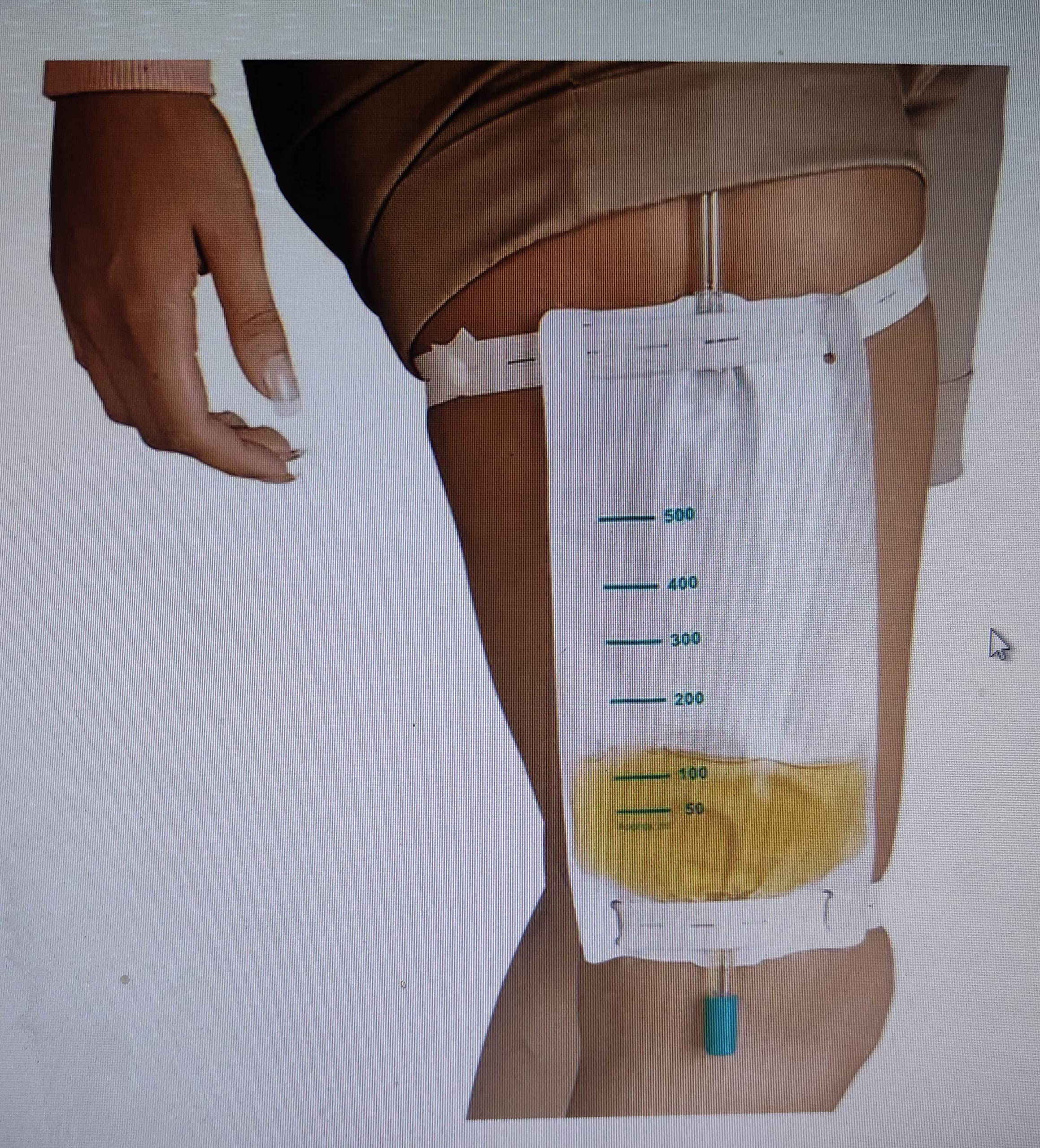 SURU Urine Bag - Leg Bag (Pack Of 3, Transparent) 1