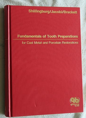 Fundamentals of Tooth Preparations for Cast Metal and Porcelain Restorations