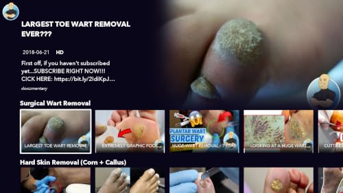 The Toe Bro – vue 2