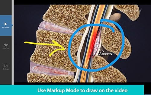 ViewMedica Patient Education Videos