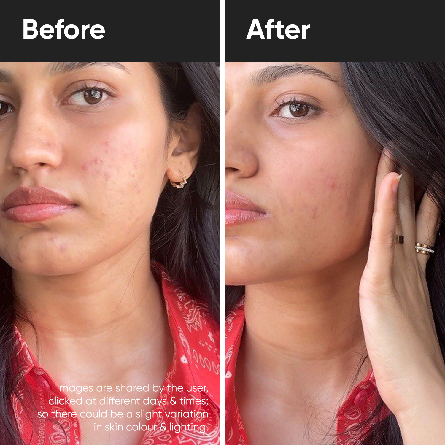 l glutathione pills before and after Buy Dr. Su Gluta Glow Supplement | 500mg L-Glutathione with Vitamin C, E, Zinc, Selenium & NAC | For Pigmentation, Dull & UV-Damaged Skin | 2 Tablets/Day | 60 Capsules LA Organo L Glutathione Tablets
