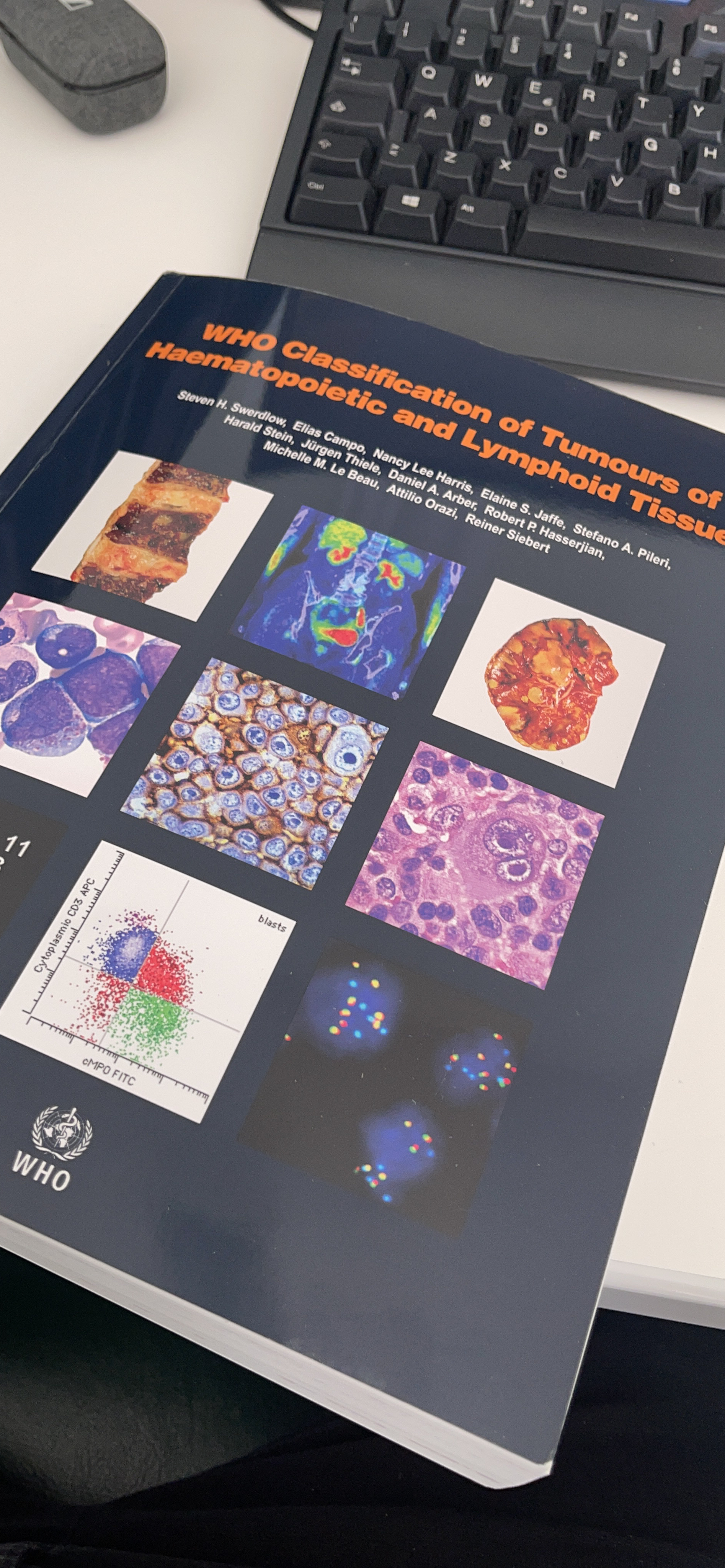 Amazon | WHO Classification of Tumours of Haematopoietic and Lymphoid ...