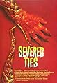 Severed Ties's primary photo