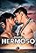 Hermoso's primary photo