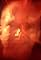 Flux's primary photo