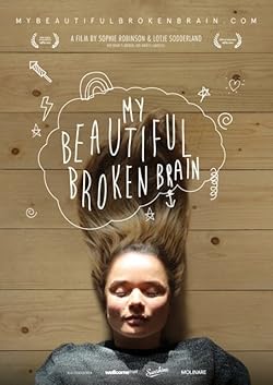 Poster of My Beautiful Broken Brain