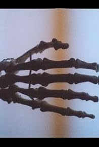 Primary photo for Metacarpus