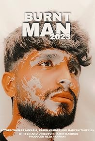 Primary photo for Burnt man