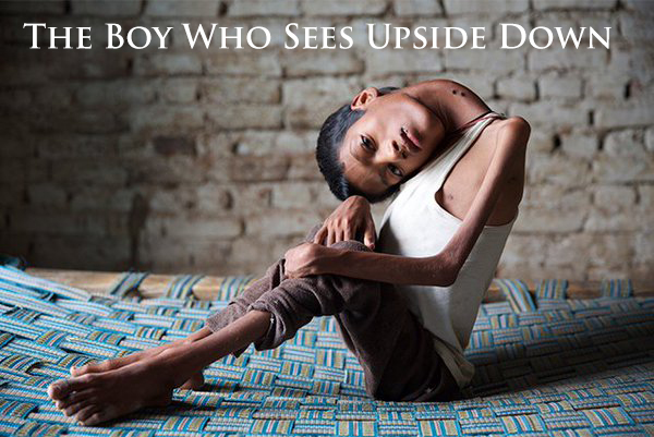 Poster of The Boy Who Sees Upside Down