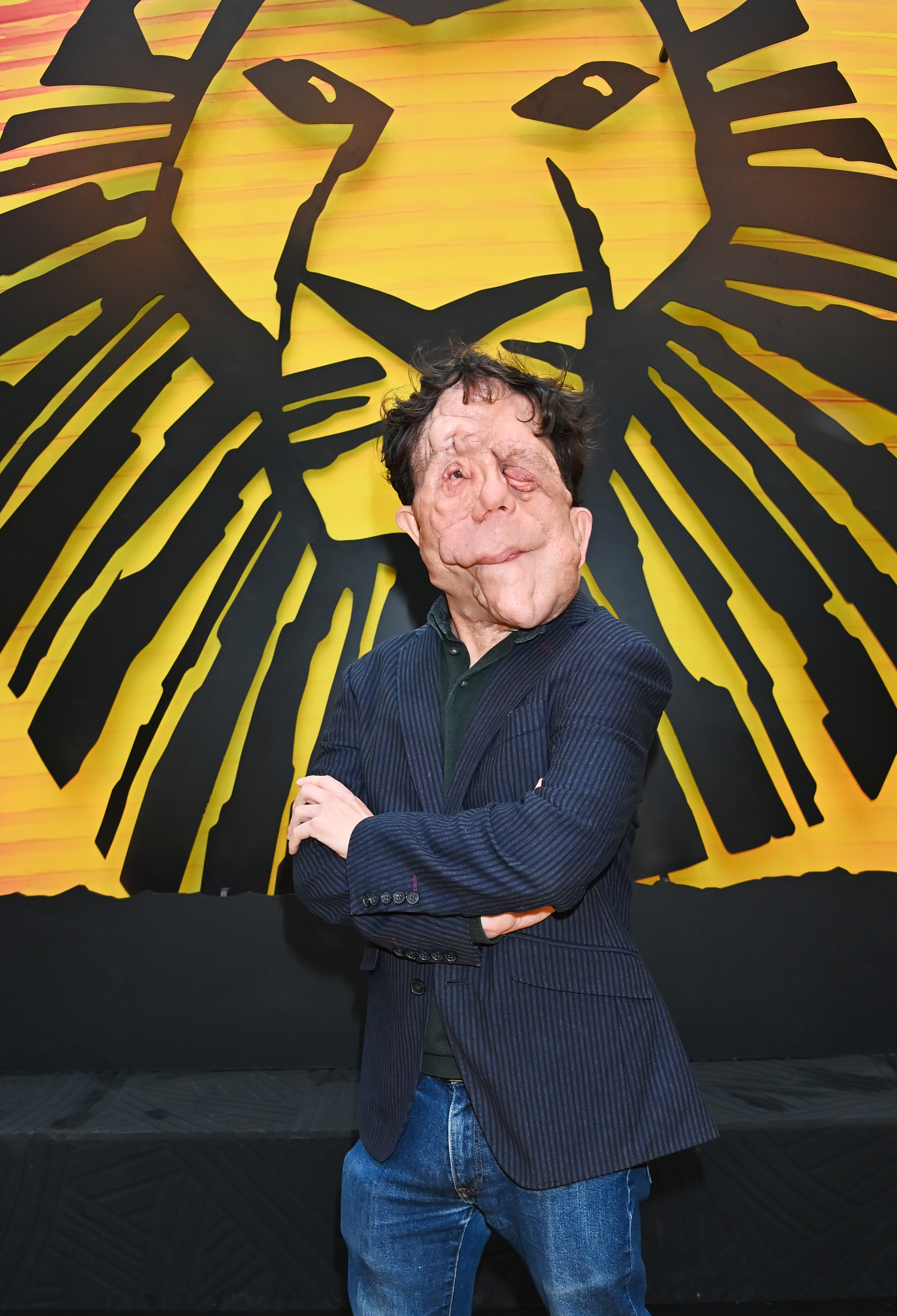 Adam Pearson at an event for The Lion King (1994)