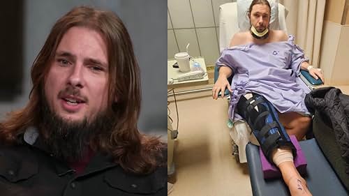 90 Day Fiancé: Colt Undergoes Multiple Surgeries After Terrifying Accident - IMDb