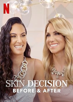 Poster of Skin Decision: Before And After