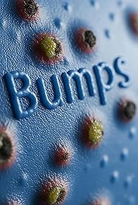 Primary photo for Bumps