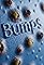 Bumps's primary photo