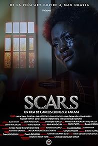 Primary photo for Scars Primary photo for Scars