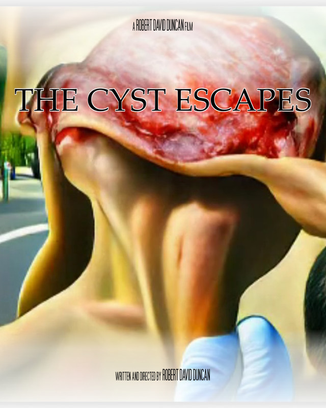 The Cyst Escapes