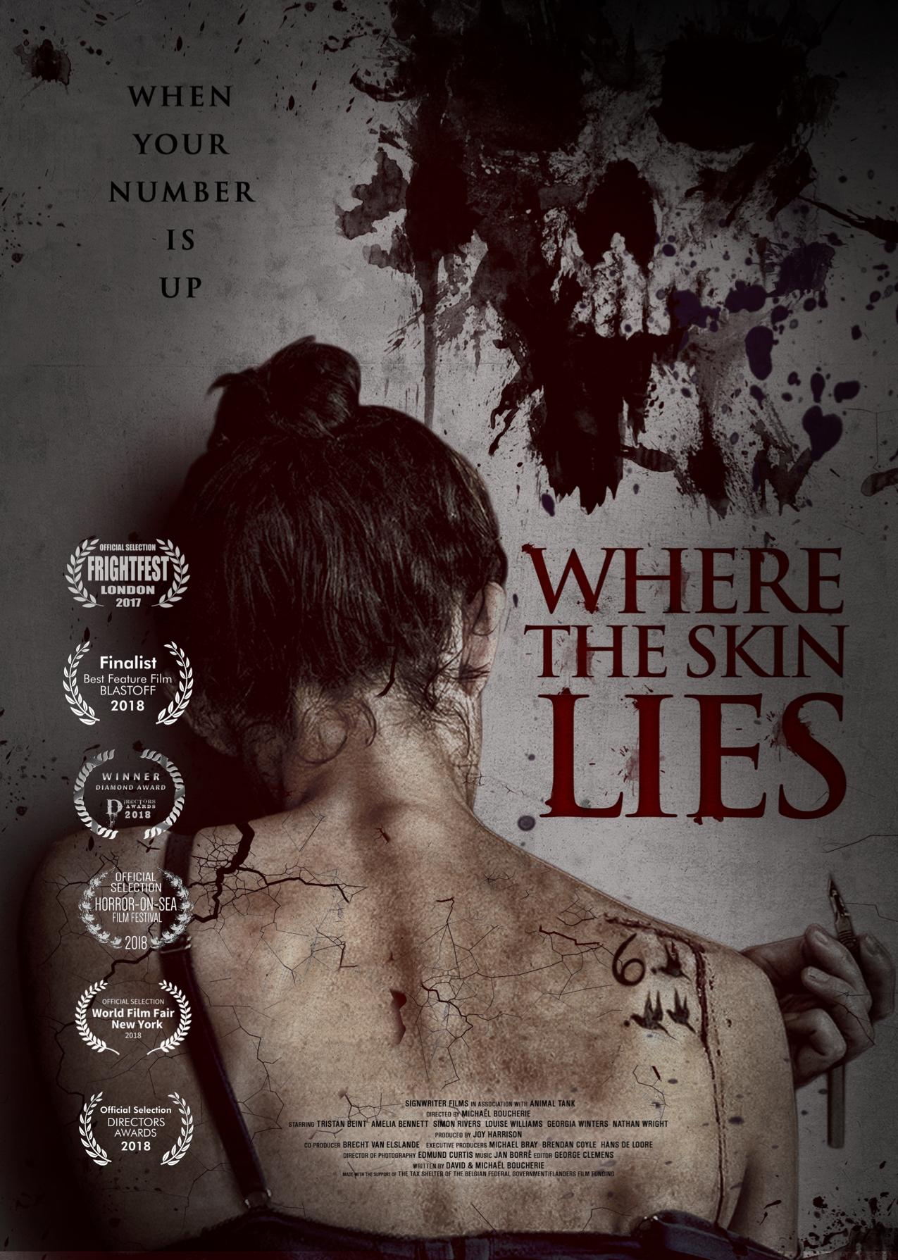 Poster of Where the Skin Lies