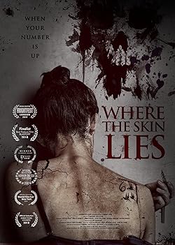 Poster of Where the Skin Lies