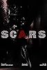Primary photo for Scars Primary photo for Scars