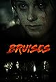 Bruises's primary photo