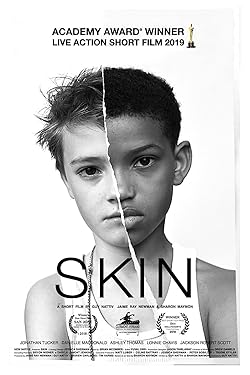 Poster of Skin