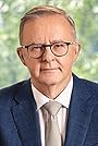 Anthony Albanese's primary photo Anthony Albanese's primary photo
