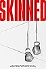 Primary photo for Skinned