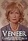 Veneer's primary photo