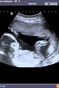 Primary photo for Fetal Heart Echography