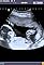 Fetal Heart Echography's primary photo