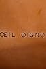 Primary photo for Oeil oignon