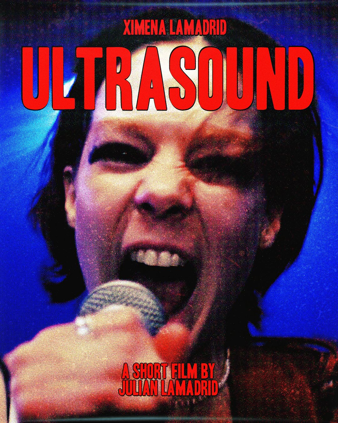 Ultrasound