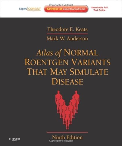 Atlas of Normal Roentgen Variants That May Simulate Disease book cover