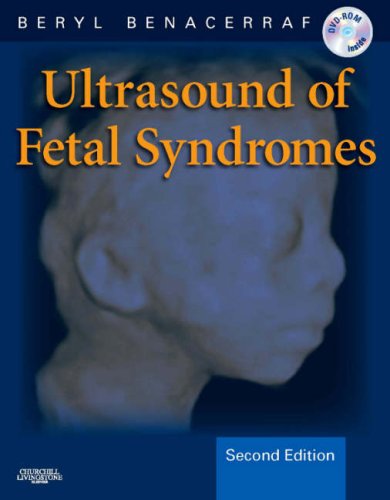 Ultrasound of Fetal Syndromes: Text with DVD book cover
