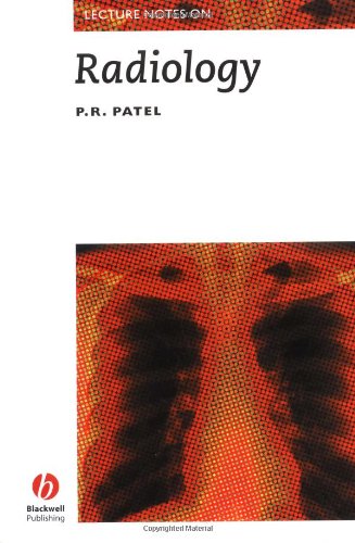 Lecture Notes on Radiology book cover