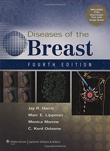 Diseases of the Breast book cover
